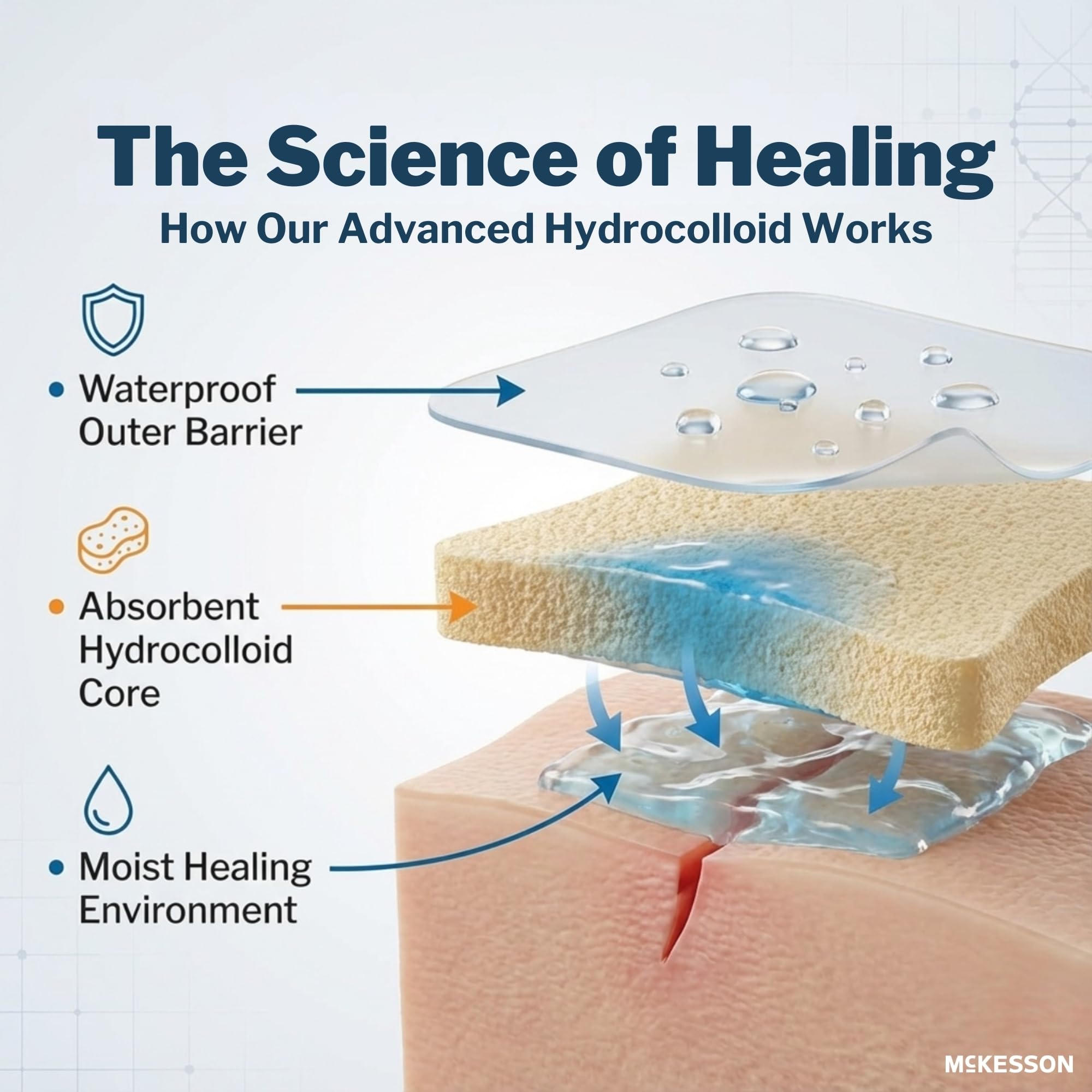 McKesson Hydrocolloid Dressing, Sterile, Thin (20 Boxes, 400 Dressings Total) - Self-Adhesive Sterile Bandage, Waterproof Patch for Bed Sore, Mild Burn, Blister, Acne Care - 2 in x 2 in - Image 4